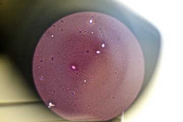 Eyacular con frecuencia mejora la calidad del esperma, según el mayor estudio hasta la fecha