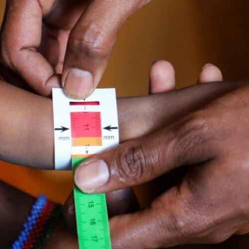 Se agrava la crisis de desnutrición en Somalia