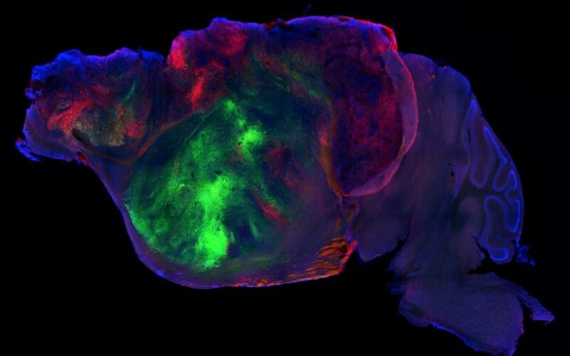 Ratones con millones de neuronas humanas en su cerebro acercan la respuesta a enfermedades mentales